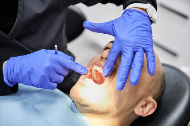 Best Emergency Dental Services for Seniors in Brownsboro, TX