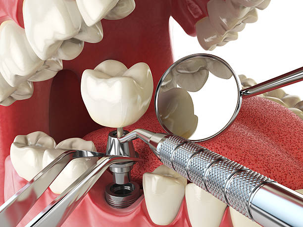 Best Orthodontic Emergency Dentist in Brownsboro, TX